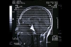 【2026年最新版】みなとみらいで快適に大腸検査を受けるための完全ガイド